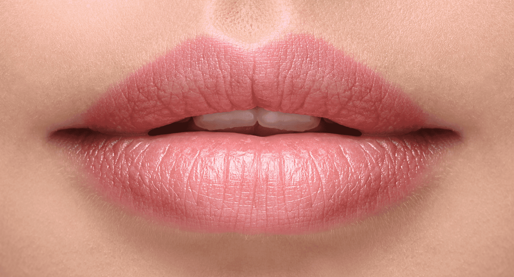 HEART SHAPE - Sacramento Lips Inyectables